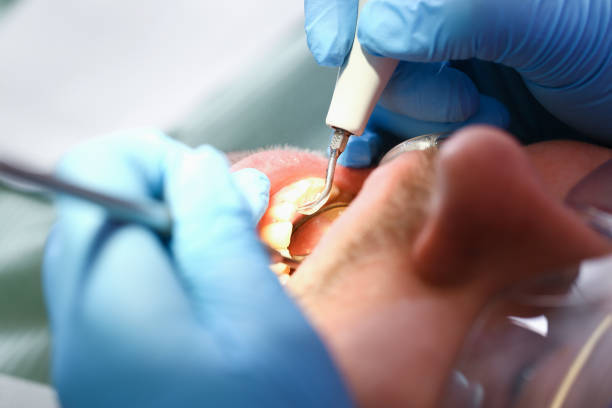 Best Emergency Dental Care for Abscessed Tooth in Hudson, IA