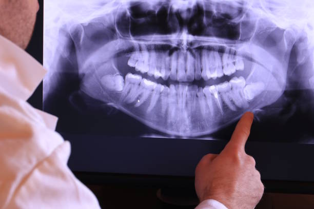 Best Emergency Dental Services for Seniors in Hudson, IA